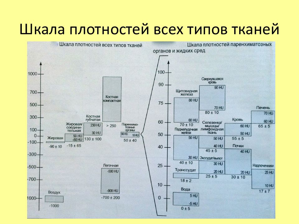 Шкала хаунсфилда презентация