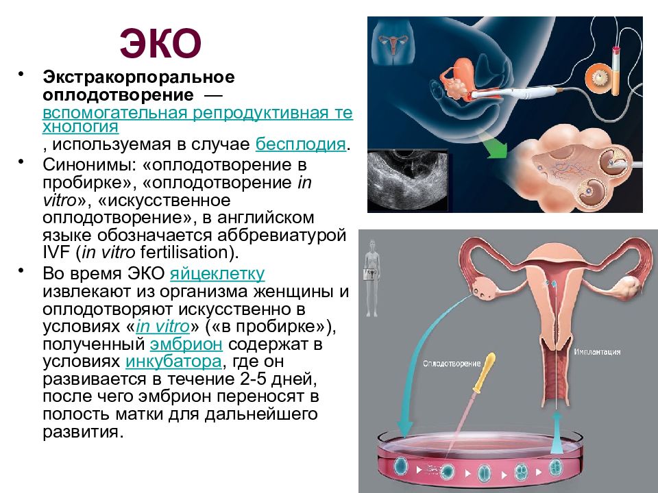 Картинки экстракорпоральное оплодотворение