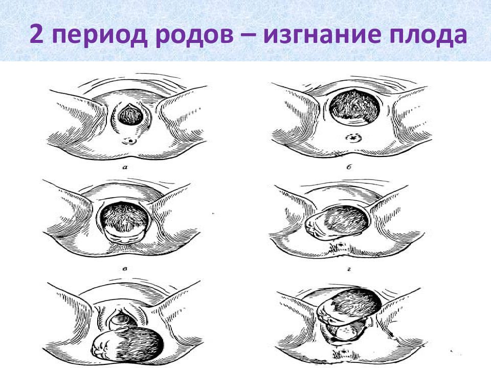 Периоды родов картинки
