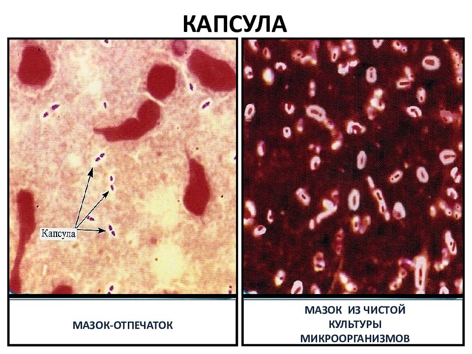 агар агар питательная среда. чистая культура бактерий это в микробиологии. культура микроорганизмов 5. Micrococcus luteus микробиология. Klebsiella pneumoniae бурри гинса.