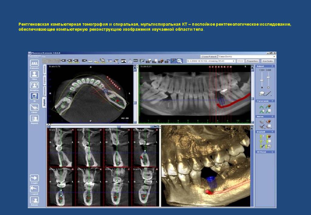 Лучевое исследование челюстно лицевой зоны презентация