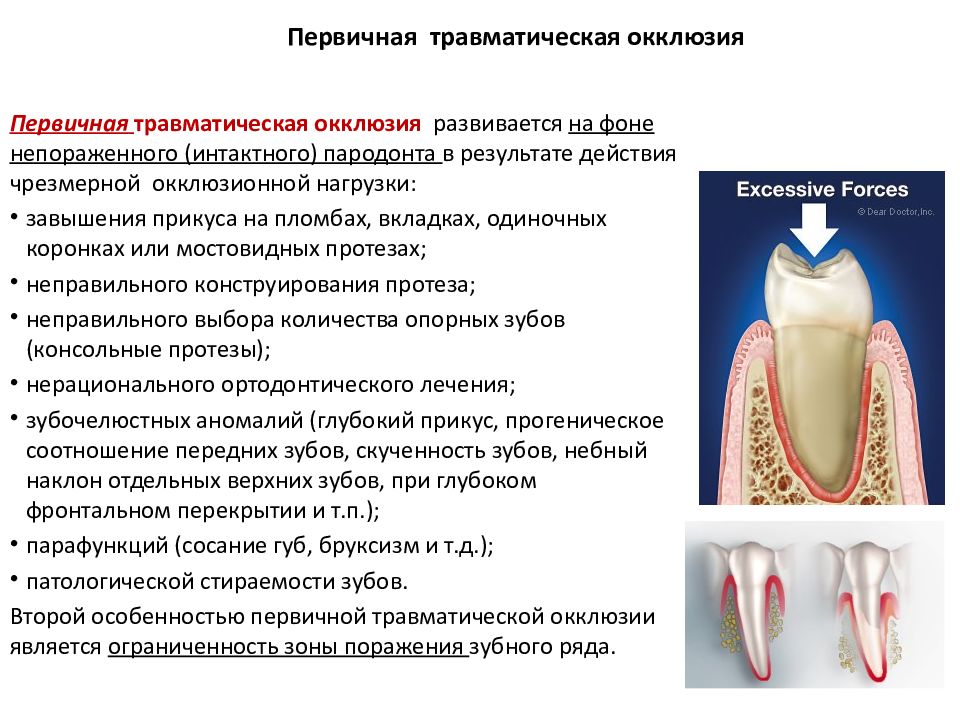 Этиология патогенез клиника заболеваний пародонта презентация