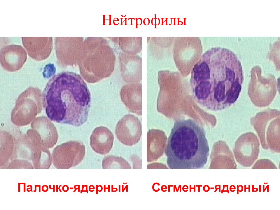 Палочкоядерные нейтрофилы картинки