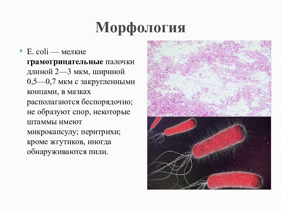Escherichia coli что это у мужчин. Кишечная палочка эшерихиоз. Кишечная палочка морфология. Морфология кишечной палочки микробиология. Энтеропатогенные кишечные палочки.