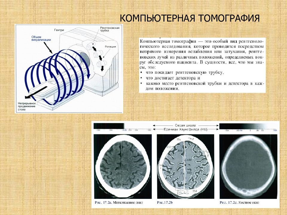 Цель компьютерной томографии. Опухоли головного и спинного мозга у детей. Типы компьютерных томографов. Атлас компьютерной томографии. Компьютерная томография статистика.