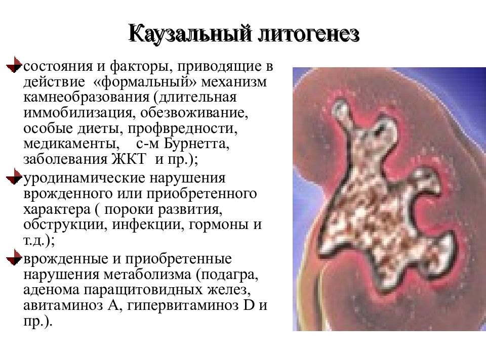 Каузальный это. Формальный и Каузальный механизмы камнеобразования. Формальный механизм камнеобразования. Каузальный механизм камнеобразования это. Формальный генез и Каузальный генез.