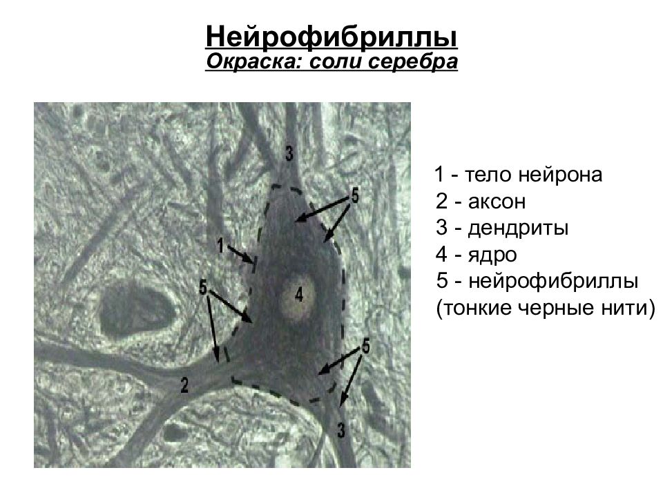 Мультиполярный нейрон спинного мозга рисунок