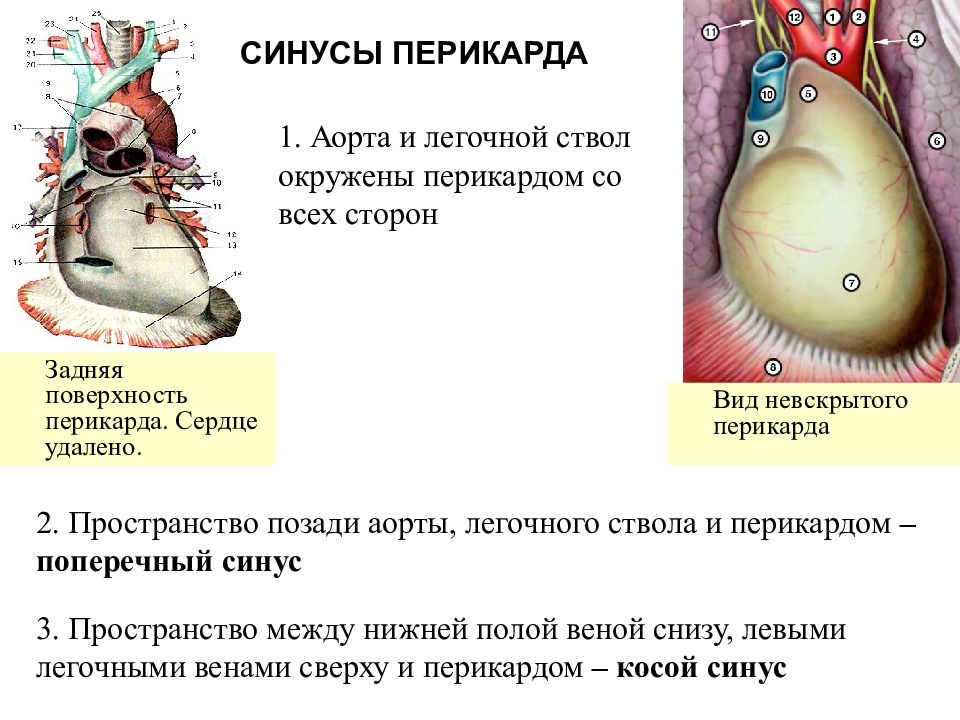 Передний нижний синус перикарда