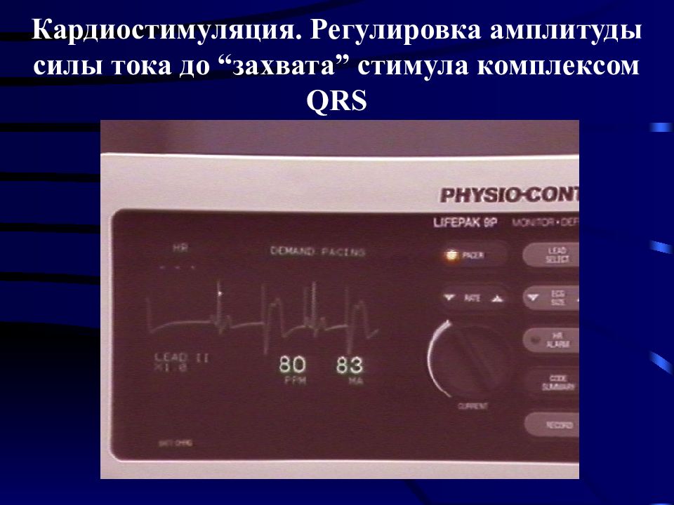 Электроимпульсная терапия презентация