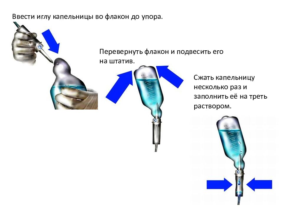 Где Поставить Капельницу Недорого