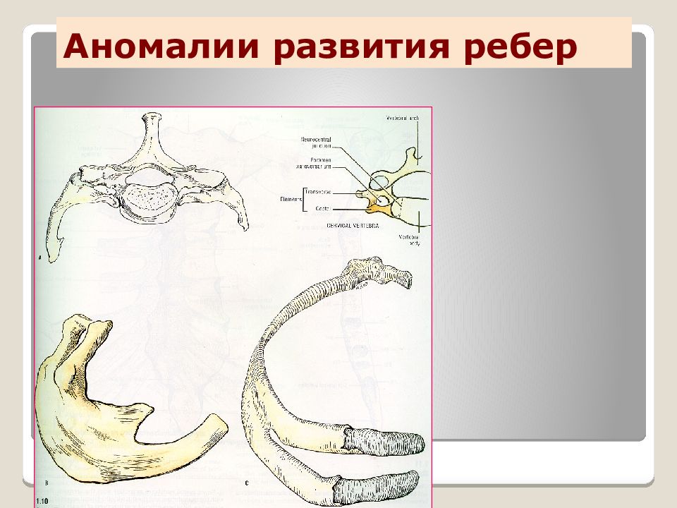 Аномалии развития уха презентация