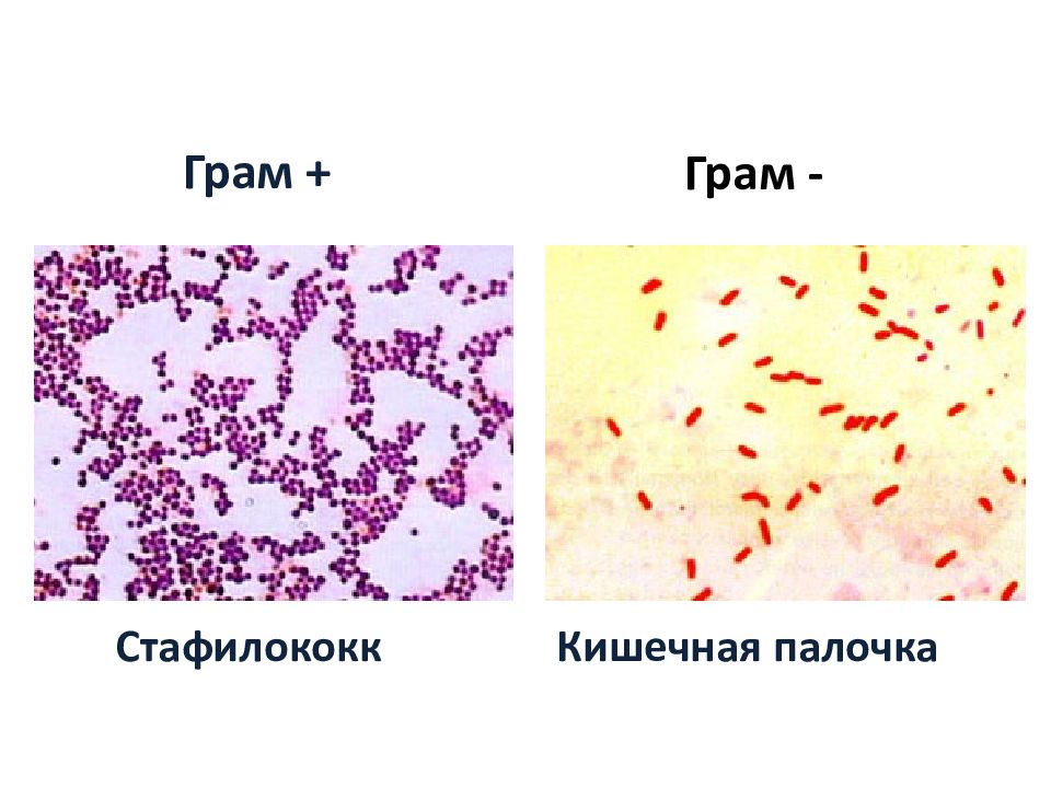 Грамположительные и грамотрицательные бактерии презентация