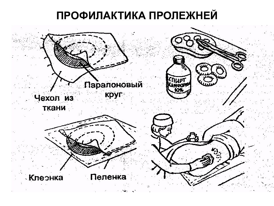 Профилактика образования пролежней презентация