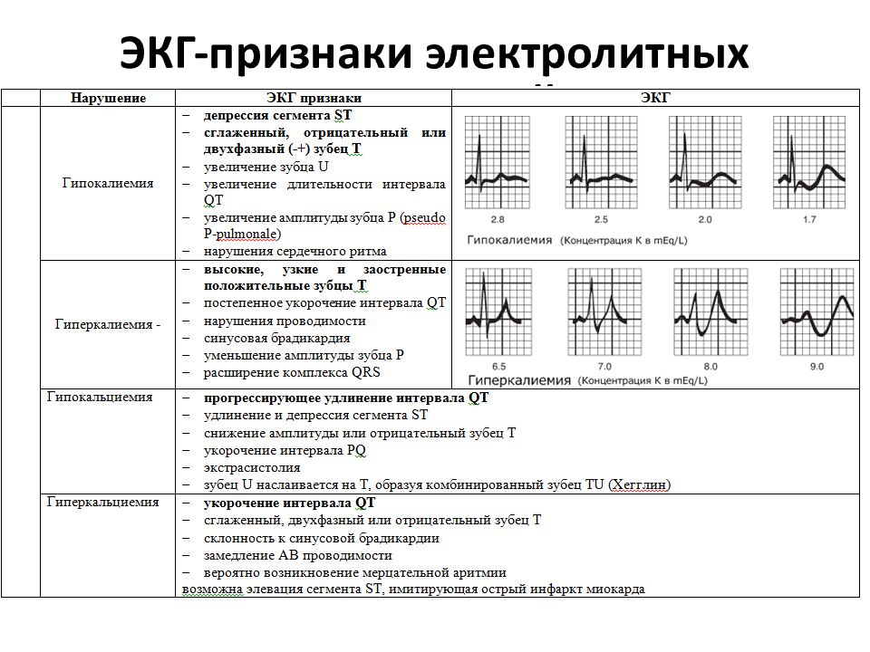 Экг в схемах и таблицах