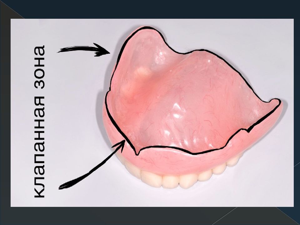 Полный съемный пластиночный протез презентация