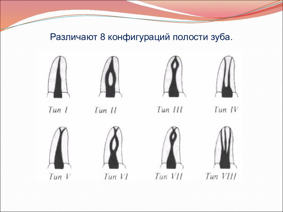 Устья корневых каналов схема