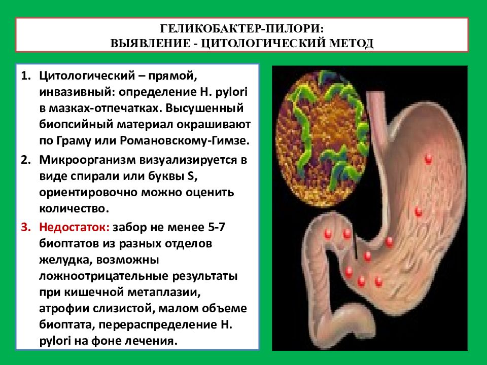 Инструментальные методы исследования органов пищеварения. Инвазивный метод диагностики пилорических геликобактеров. Геликобактер негативный что это значит. Бронхокарсинол.г.б. Иммунлюминесцентное обнаружение геликобактера картинки.