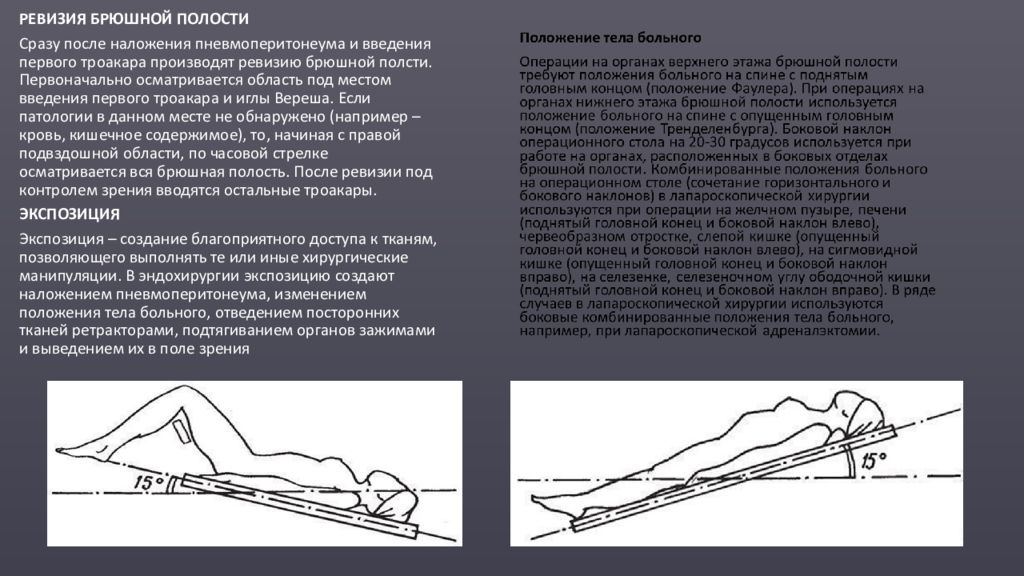 Положение больного на столе