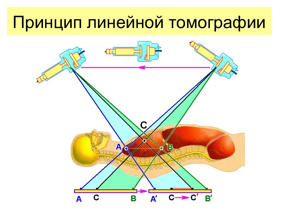 Линейный принцип работы. Линейная рентгеновская томография. Линейная томография принцип метода. Линейная томография схема.