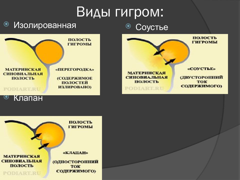 Повреждения и заболевания коленного сустава презентация