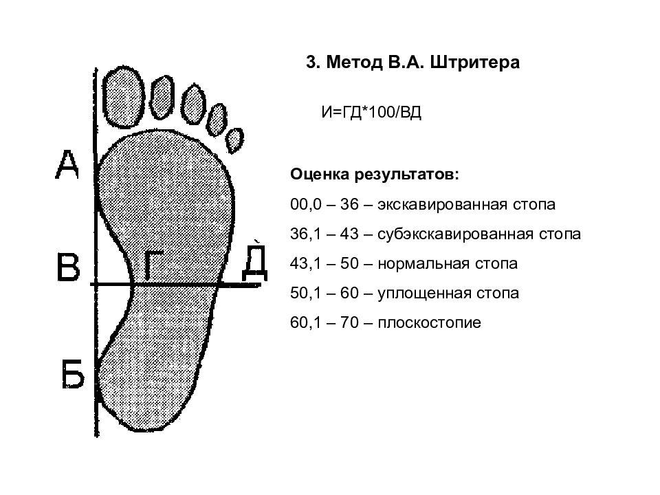 Плоскостопие биология. Метод Штритера степени плоскостопия. Плантография (по методу в.а.Яралова- Яралянца).. Оценка стопы по методике Штритера. Метод Чижина плоскостопие.