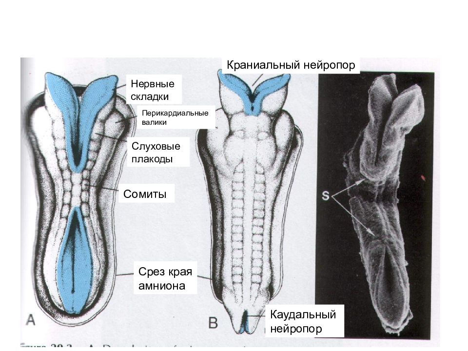 Краниальный это. Нервная трубка. Краниальная часть нервной трубки. Развитие нервной трубки. Формирование нервной трубки.