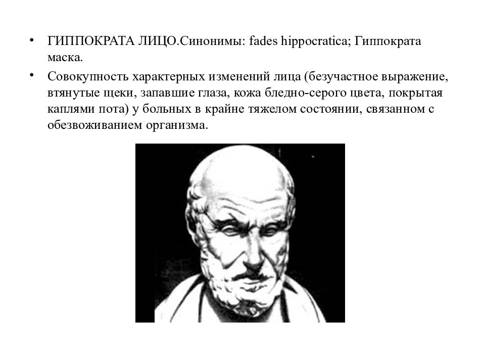 Лицо синоним. Выражение лица Гиппократа. Лицо Гиппократа симптом.