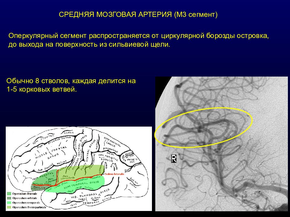 Артерии среднего мозга. Средняя мозговая артерия. Сегменты артерий мозга. Сегменты средней мозговой артерии. Средняя мозговая артерия кт.