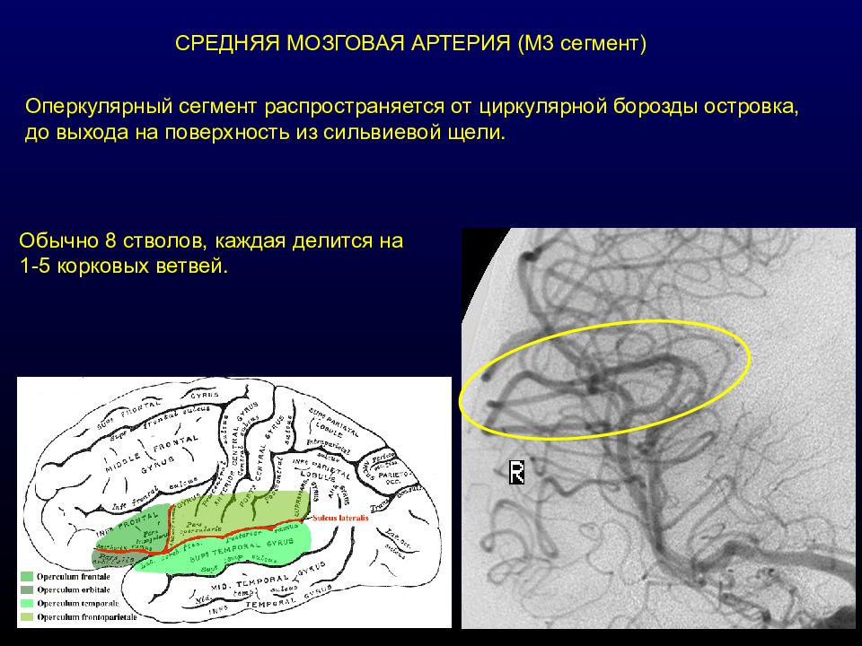 Средняя мозговая артерия. Сильвиевой щели головного мозга анатомия. Анатомия средней мозговой артерии сегменты. М1 сегмент средней мозговой артерии. Сильвиева щель в головном мозге.