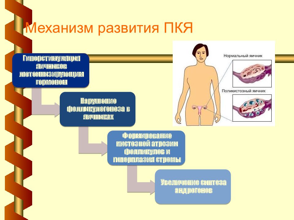 Поликистоз яичников презентация