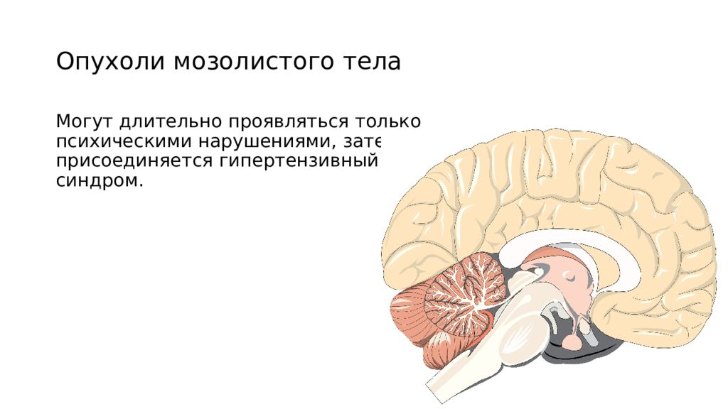 Опухоли нервной системы неврология презентация