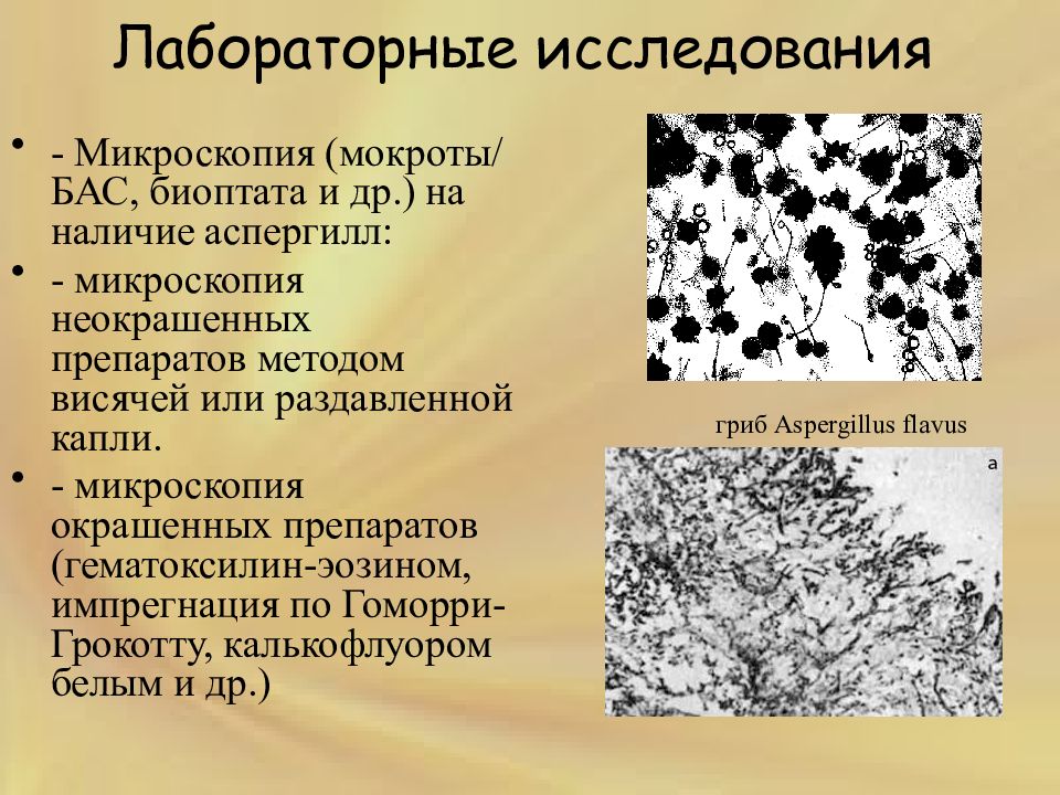 Аспергиллез микробиология презентация