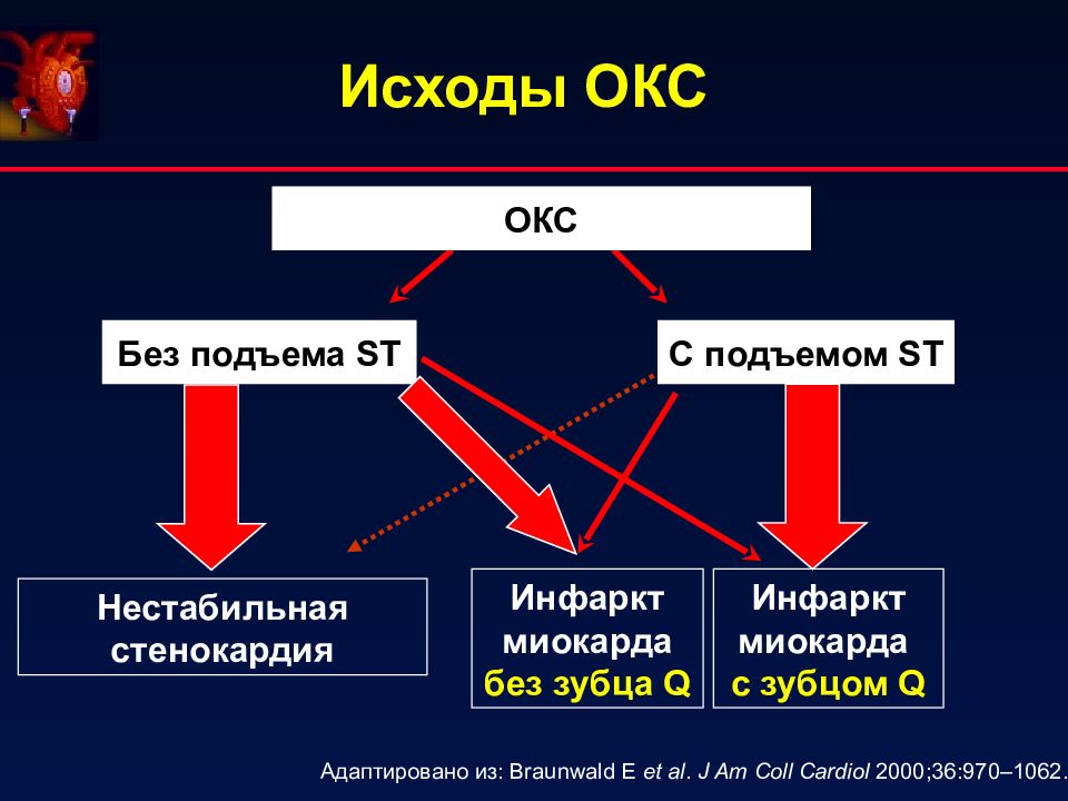 Инфаркт миокарда без подъема сегмента st презентация