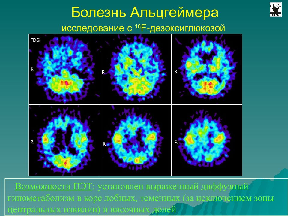 Лучевая диагностика нервной системы презентация