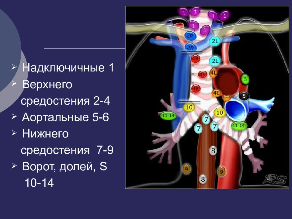 Лимфоузлы средостения легкого. Лимфатические узлы средостения на кт. Кт анатомия лимфатических узлов средостения. Лимфатические узлы грудной клетки кт. Лимфоузлы средостения кт.