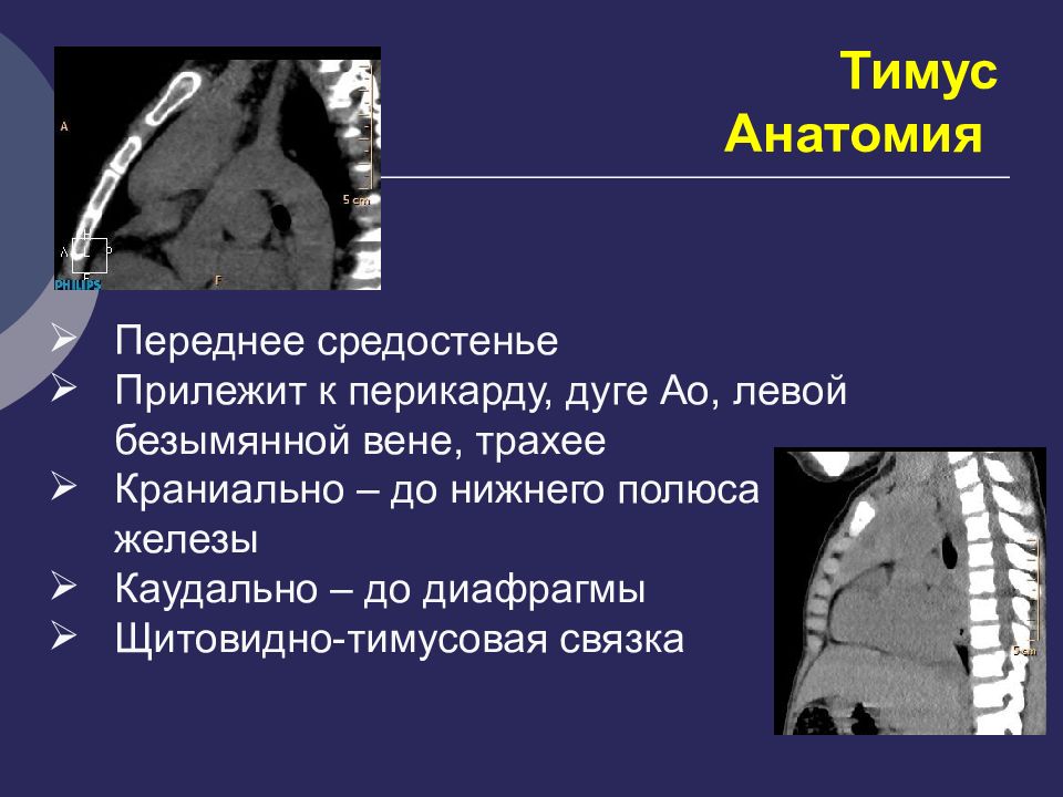 Образования средостения схема