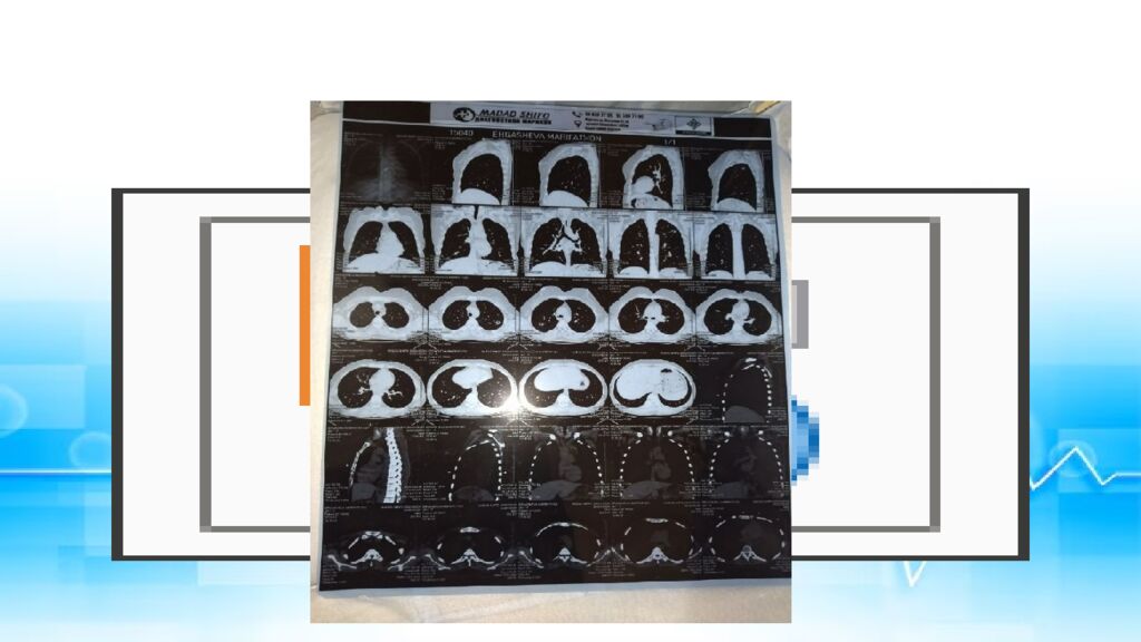 CENTRAL ASIAN MEDICAL UNVERSITETI DAVOLASH ISHI FAKULTETI 421-GURUH TALABASI