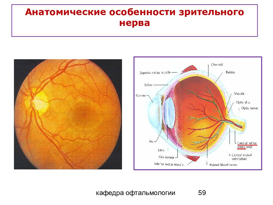 Норма глазного дна. Глазное дно при отслойке сетчатки. Схема глазного дна. Анатомические особенности зрительного нерва.