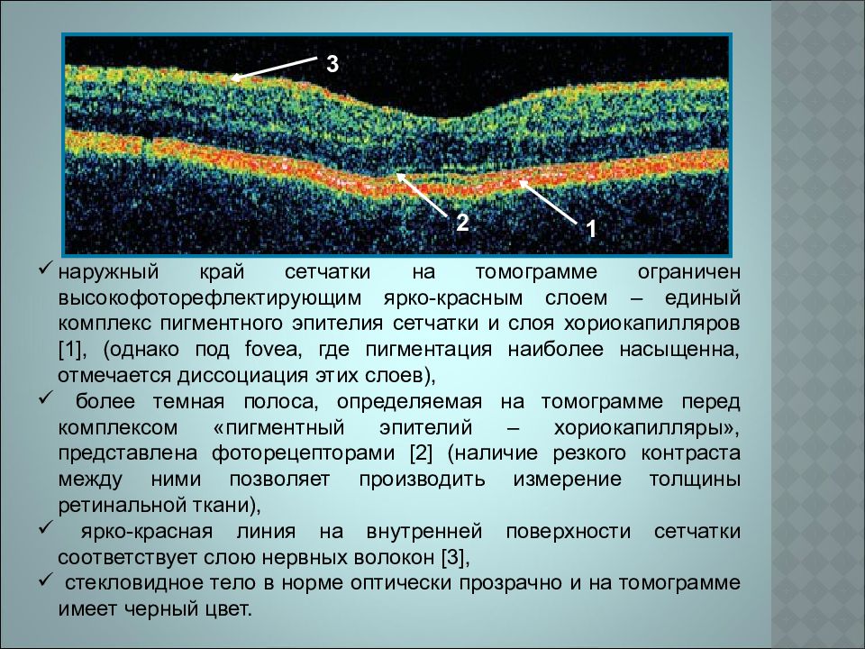 Нормальная область. Оптическая когерентная томография норма. Оптическая когерентная томография сетчатки глаза. Оптическая когерентная томография слои сетчатки. Слои сетчатки глаза на окт.