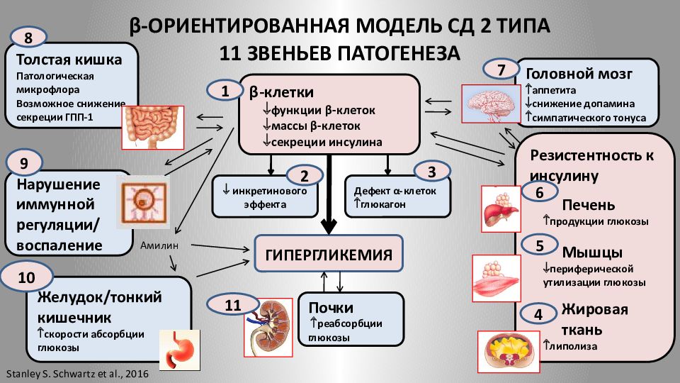 Для клинической картины инсулинозависимого сахарного диабета характерны