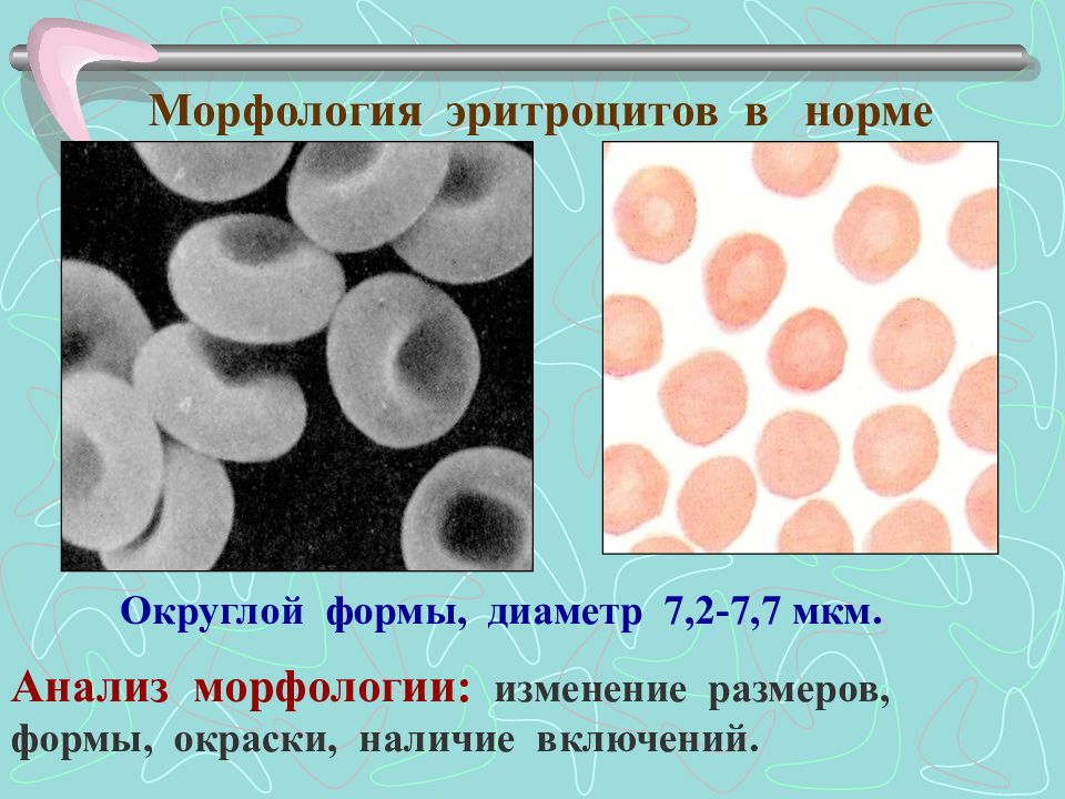 Наличие включений. Морфология эритроцитов в крови анализ. Морфология эритроцитов в норме. Изменение морфологии эритроцитов. Гранулы эритроцитов.