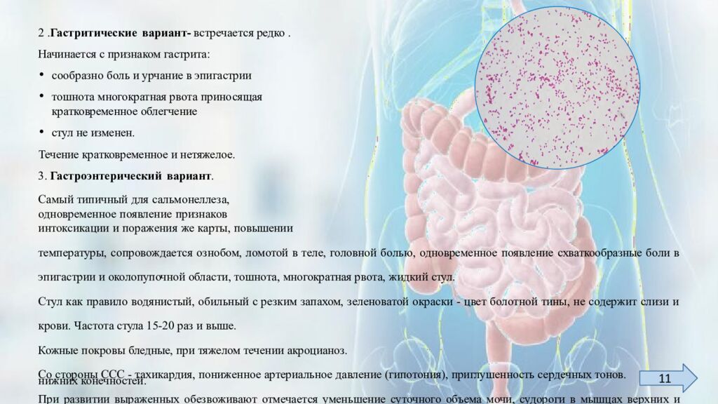 Сальмонеллез