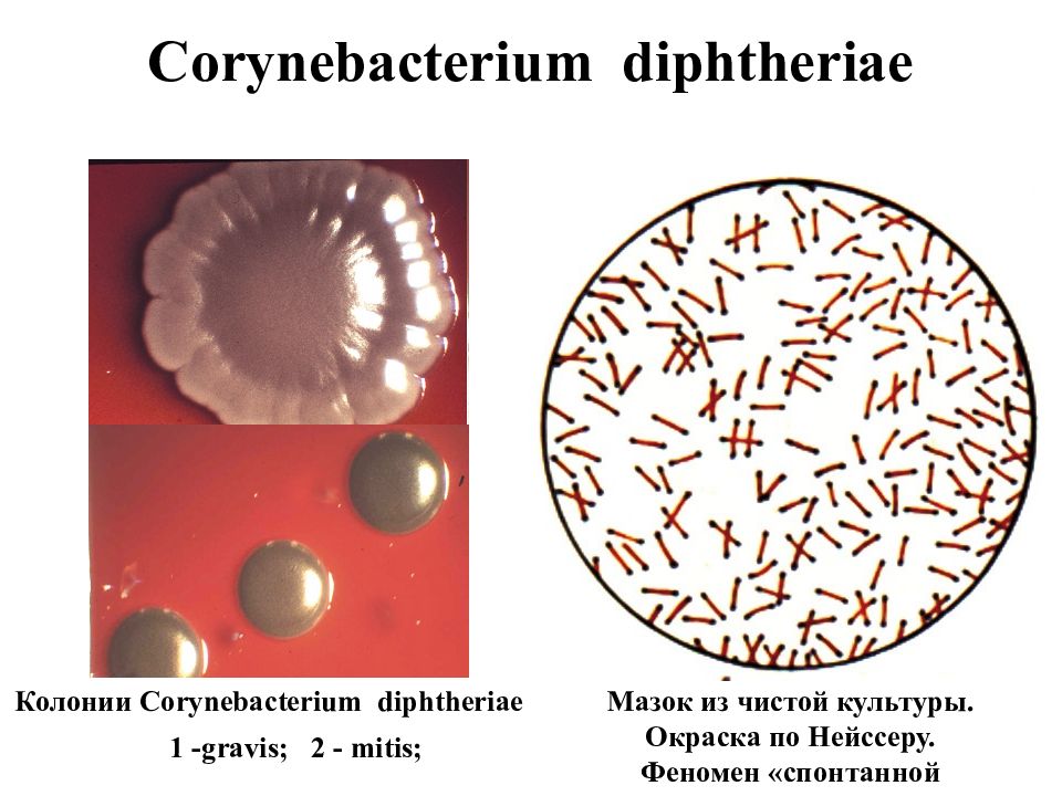 Corynebacterium diphtheriae фото