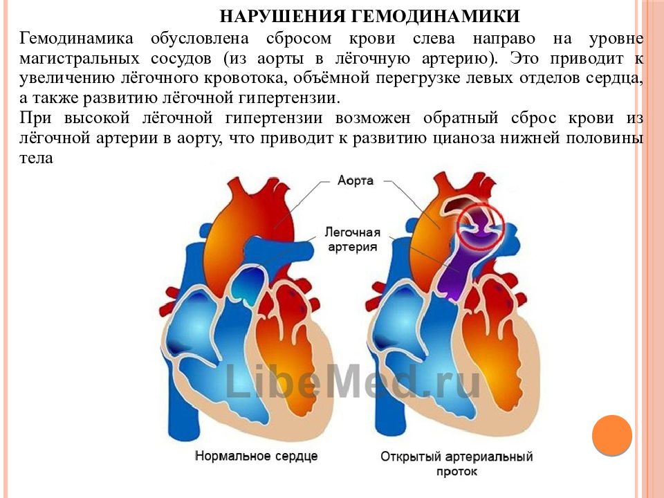 Что значит нарушение гемодинамики. Нарушение гемодинамики при пороках сердца. Гемодинамика при пороках сердца. Стабильная гемодинамика это. Легочная недостаточность.