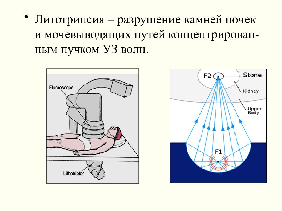 Основная тканевая характеристика ультразвукового изображения