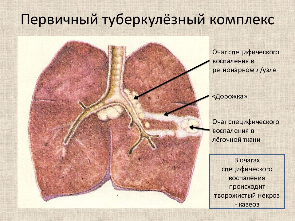 Казеоз это