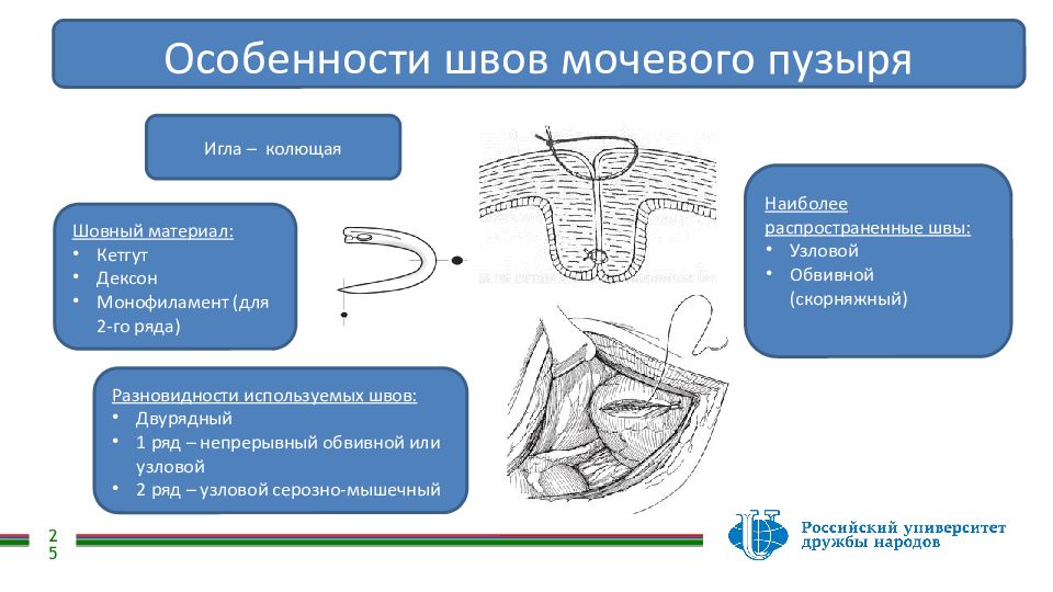 Операция мочевого. Ушивание раны мочевого пузыря. Шов мочевого пузыря Оперативная хирургия. Наложение швов на мочевой пузырь.