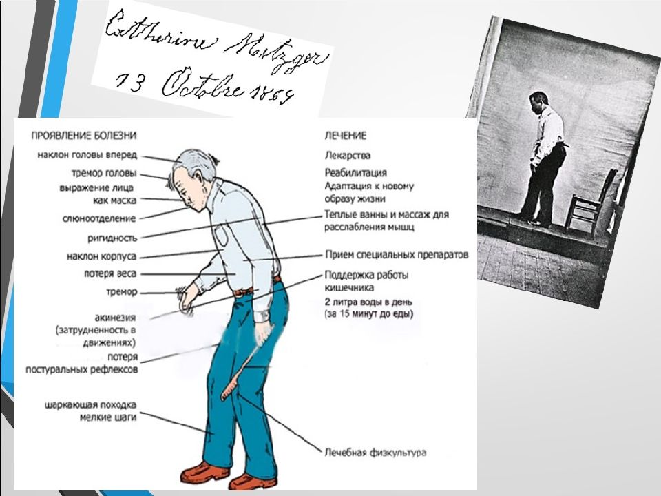 Синдром паркинсонизма презентация