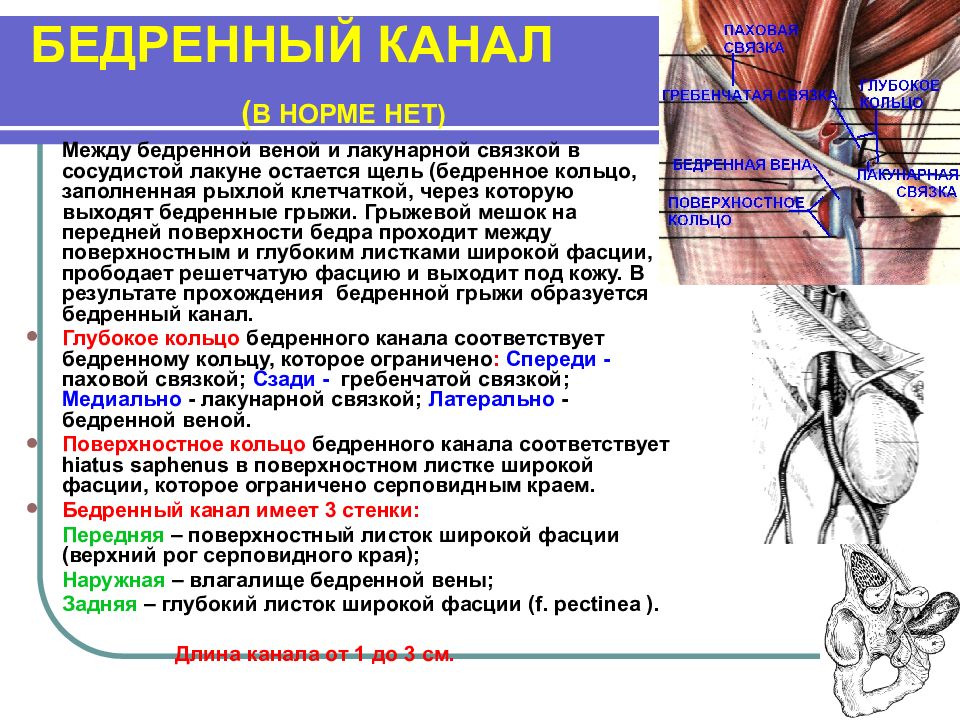 Бедренной вене. Катетеризация бедренной вены. Пункционная катетеризация бедренной вены.