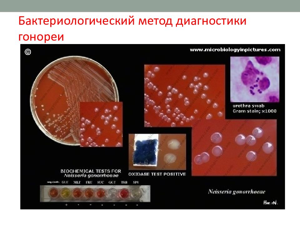 Иппп гинекология презентация